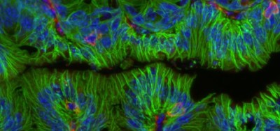 This confocal microscope image shows intestine tissue from a mouse that has been stained to visualize epithelial cells lining the intestinal lumen (EpCAM, green) and underlying immune cells (CD45, green). Nuclei are stained with DAPI (blue). Credit: Taylor Rice, Emily Eshleman, and Theresa Alenghat. Cincinnati Children’s.