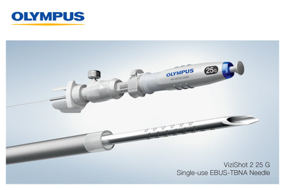 Olympus announces the launch of the ViziShot 2 25 G, the smallest of the Olympus EBUS-TBNA needle portfolio, expanding physician capabilities in lung cancer diagnosis and staging.