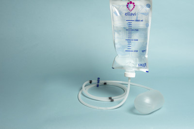 The Sinapi Ellavi Uterine Balloon Tamponade, a low-cost, preassembled device used in multiple countries to manage postpartum hemorrhage. Photo credit: PATH/Patrick McKern.