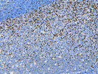 Biocare Medical and Bethyl Laboratories Announce the Launch of TIGIT IVD Rabbit Monoclonal Antibody for Immunohistochemical Applications