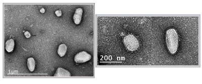 Electron microscopy (EM) images of SARS-CoV-2 Virus-like Particles (VLPs) showing the typical spikes radiating from the surface of the particles.These structural mimics of the native virus are being used to develop a COVID-19 vaccine.