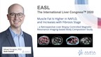 AMRA Medical Will Present a Study on MRI-Based Body Composition in Liver Disease at The Digital International Liver Congress™ 2020