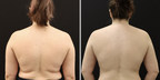 Tighten and Firm with Dr. Robert Whitfield's Latest Noninvasive Makeover Service