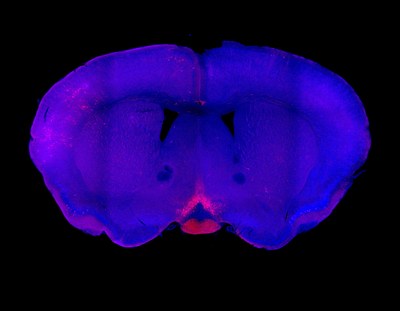 This coronal view of a mouse brain shows the location of light-sensing cells relative to the rest of the brain. Uppermost in blue are the two cortical hemispheres. The light sensing cells are located in the Eiffel Tower-shaped patch in the hypothalamus at the base of the brain.