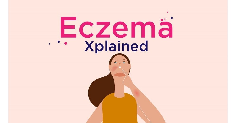 Medicine X Launches Eczema Xplained Patient Story To Drive Understanding and Awareness of Atopic Dermatitis