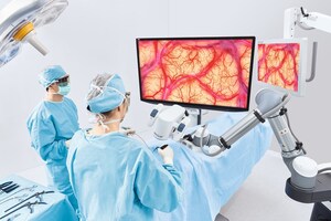 True Digital Surgery And Aesculap, Inc. Launch The Aesculap Aeos™ Robotic Digital Microscope