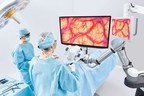True Digital Surgery and Aesculap AG Launch the Aesculap Aeos® Robotic Digital Microscope