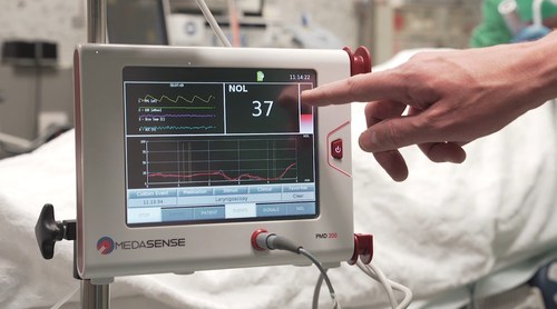 Medasense’s NOL technology for pain-response monitoring enables clinicians to personalize treatment: control pain, avoid overdose, and eliminate doubt. The technology is currently utilized in operating rooms and critical care settings, where patients are under anaesthesia and unable to communicate.