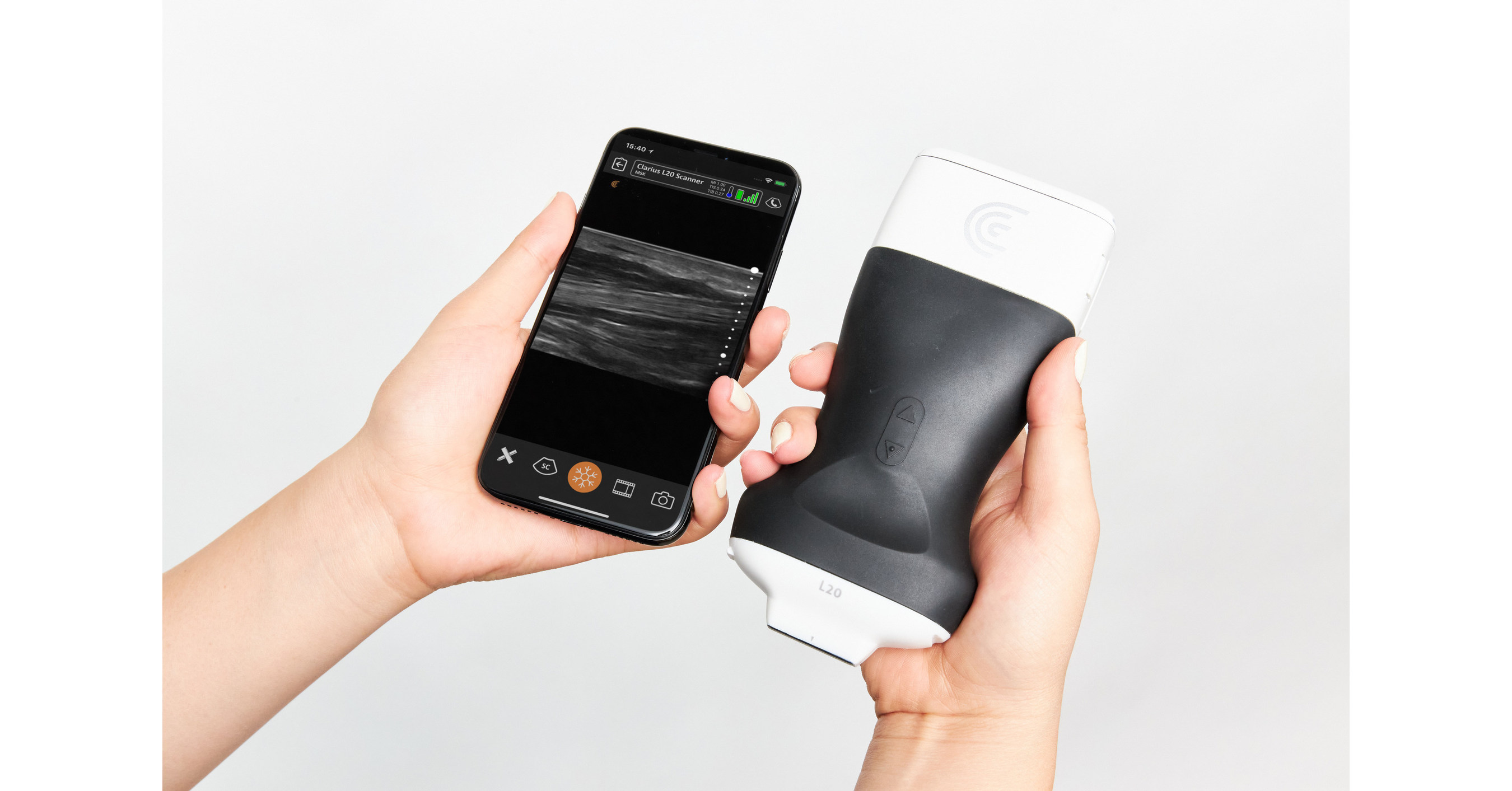 Mince Vend tilbage violet Clarius Introduces the World's First Ultra-High Frequency Handheld  Ultrasound Scanner