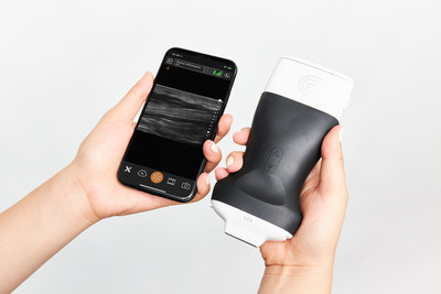 Clarius L20 HD handheld ultrasound scanner is designed to provide extremely high image quality for shallow anatomy.