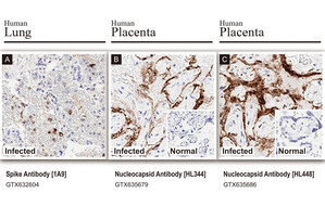 GeneTex SARS-CoV-2 Nucleocapsid and Spike Antibodies Independently Validated by HistoWiz for Immunohistochemistry