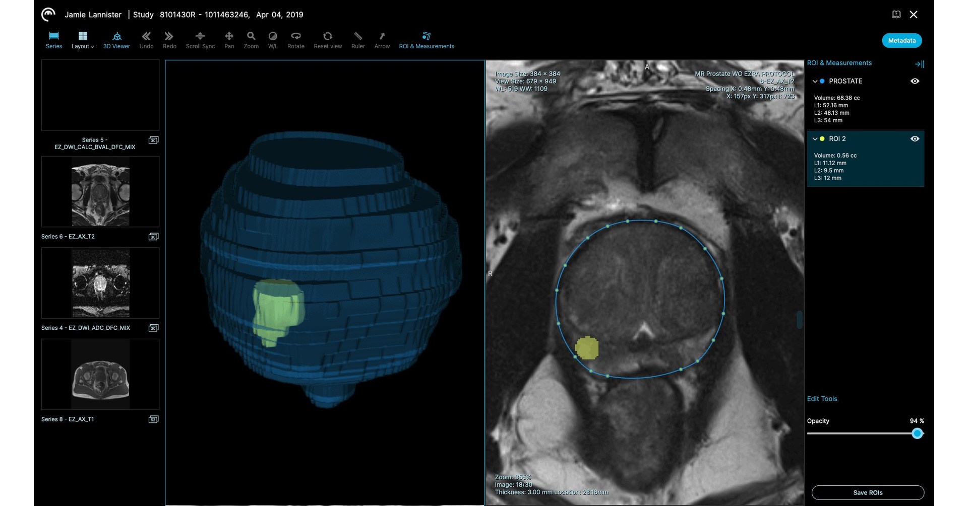 What You Need To Know Before Getting a Full-Body CT Scan - Ezra