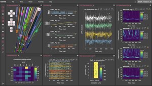 SUNY Downstate and MetaCell launch a graphical tool to model, simulate and analyze brain neuronal circuits