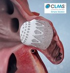 Conformal Medical's CLAAS® Stroke Prevention Technology Announces Promising Clinical Results at 2020 TCT Conference