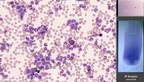 Scopio Labs Receives FDA Clearance for its AI-Powered Full Field Peripheral Blood Smear (Full Field PBS) Application