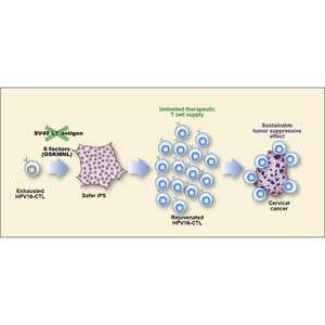 Juntendo University research: Potential immunotherapy approach to cervical cancer