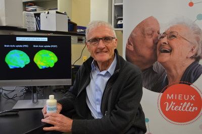 The professor and researcher Stephen Cunnane has been interested in the benefits of ketones as a source of energy for the brain. His efforts have paid off, as his research has led to a drink that can significantly improve cognitive function in people at a high risk of developing Alzheimer's disease; Photo: CIUSSS de l'Estrie ? CHUS. (CNW Group/Universit de Sherbrooke)