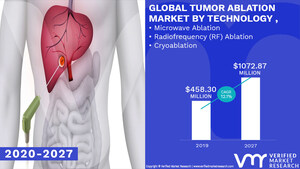 Tumor Ablation Market Worth $ 1072.87 Million, Globally, by 2027 at 12.1% CAGR: Verified Market Research