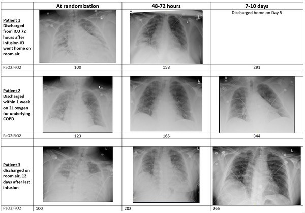 Figure: Unexpected rapid recovery from COVID-19 lung findings on chest x-ray seen in randomized prospective trial. Patients are randomized to RLF-100TM vs. placebo.  Similar findings were seen in 19 of 21 patients treated with open label RLF-100TM  (source: NeuroRx, Inc.)