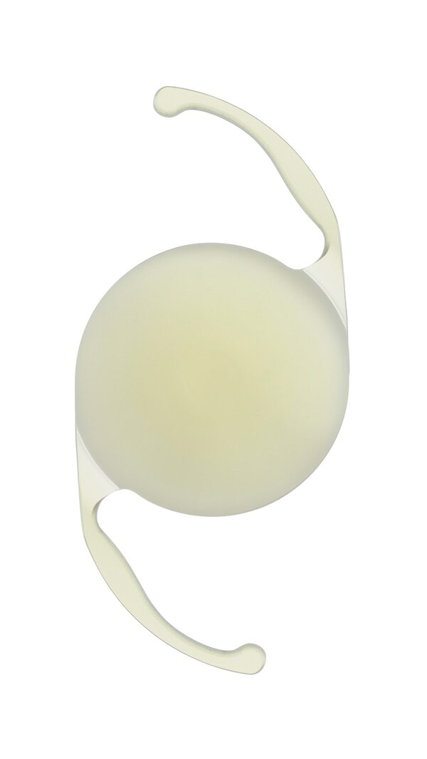 Alcon Canada introduces AcrySof IQ Vivity, the only presbyopiacorrecting intraocular lens with Alcon Canada introduces AcrySof IQ Vivity, the only presbyopiacorrecting intraocular lens with