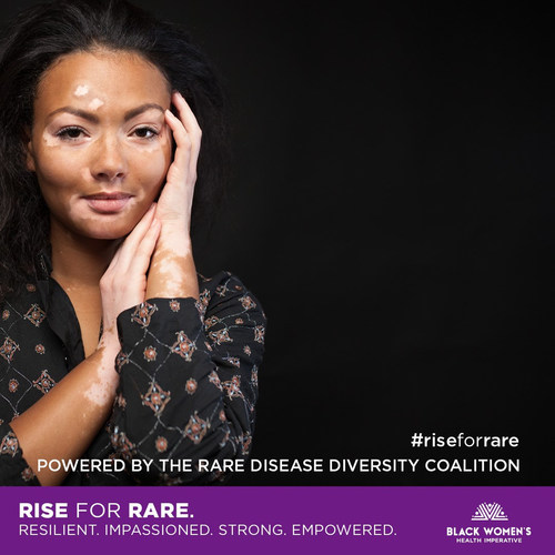 #RiseForRare A Campaign Powered By The BWHI Rare Disease Diversity Coalition