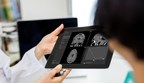 QYNAPSE to sponsor and exhibit at the 106th RSNA Annual Meeting and present its latest AI-neuroimaging advancements, which are transforming care for patients with brain disorders