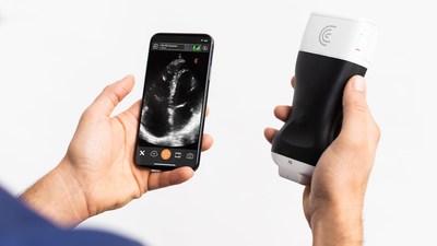 High-Definition Handheld Ultrasound Scanner Available Now for Rapid Bedside Cardiac Exams