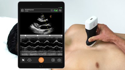 High-Definition Handheld Ultrasound Scanner Available Now for Rapid Bedside Cardiac Exams