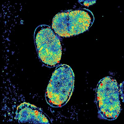 Computational microscopy enables imaging of scattering samples with rich label-free contrast. | Photograph of a collection of C. elegans embryos from CZI Deep Tissue Imaging grantee Shwetadwip Chowdhury, University of Texas.