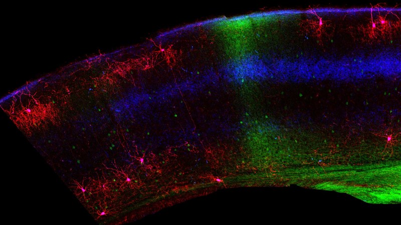 Unable to view the image, Please provide a valid URL.