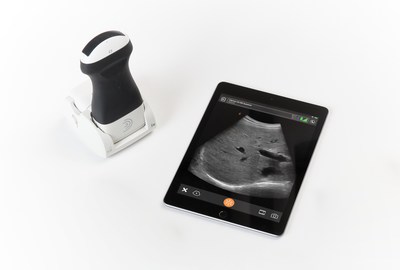 The Clarius 2-in-1 Charging Station HD makes Clarius the only handheld ultrasound scanner with continuous battery power.