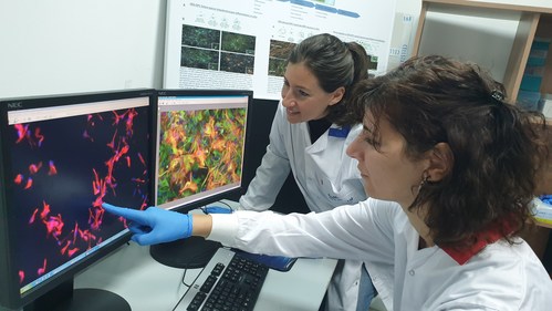 Kadimastem scientists looking at astrocyte cells comprising the AstroRx® product for the treatment of ALS (PRNewsfoto/Kadimastem)