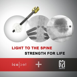 icotec ag Partners with G-21 to Provide Combined Bone Cement and Delivery Solution for Pedicle Screw Augmentation Procedures