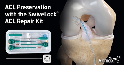 The SwiveLock ACL Repair Kit is designed as a less-invasive treatment method for certain types of anterior cruciate ligament (ACL) tears. ACL primary repair with the SwiveLock ACL Repair Kit involves reattaching a torn ACL utilizing SwiveLock anchors and high-strength FiberWire and TigerWire sutures. The kit is convenient and contains all the surgical products needed for the ACL repair technique.