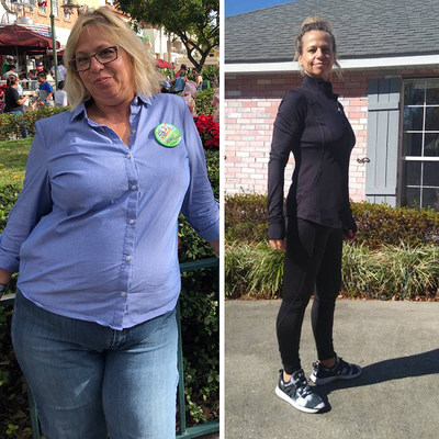 55-year-old cosmetologist and store owner - Before & After Photo