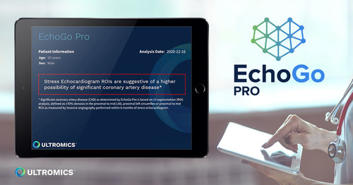 Ultromics’ EchoGo Pro uses AI to identify a higher possibility of coronary artery disease in an echo exam and sends a report to the clinician