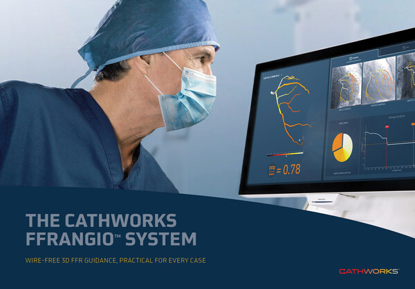 CathWorks FFRangio System
