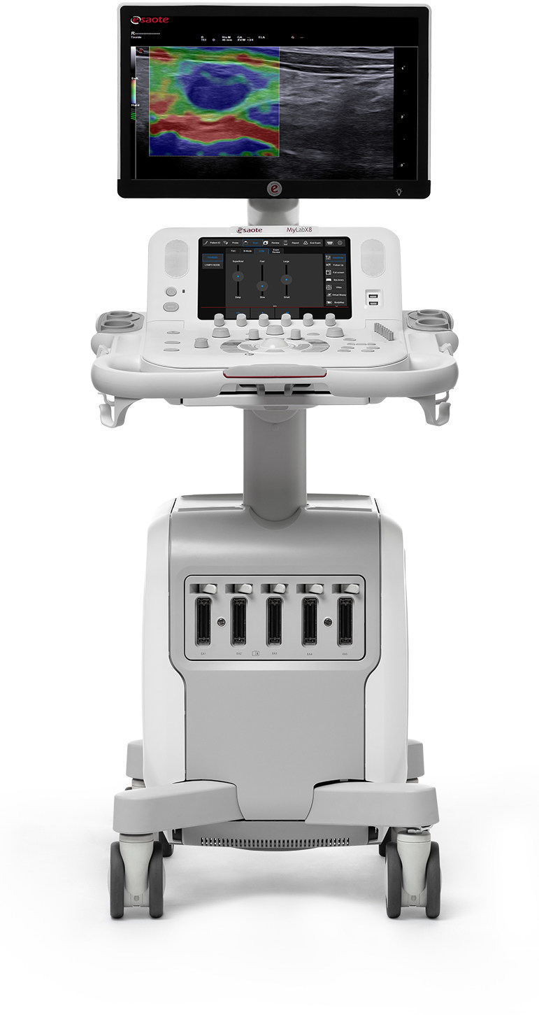 Esaote North America Introduces The Mylab™x8 Ultrasound System Into Canada A Fully Featured