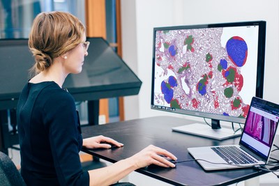 Aiforia's cloud-based AI development platform can be use for the analysis of any image in pathology for research and clinical work