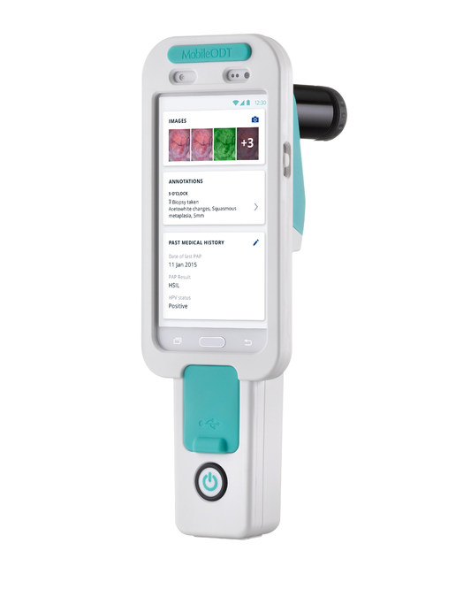 FemTech Company MobileODT awarded prestigious National Cancer Institute (NCI) grant - Vimarsana News