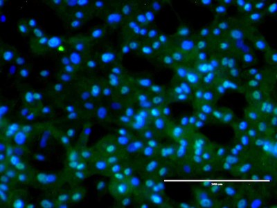 Lung surfactant protein C antibody staining (green) with nuclei staining (blue)
