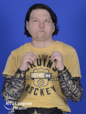 Joe DiMeo received a face and double hand transplant on August 12, 2020. This progress photo was taken almost six months after the historic operation. Joe DiMeo received a face and double hand transplant on August 12, 2020. This progress photo was taken almost six months after the historic operation.