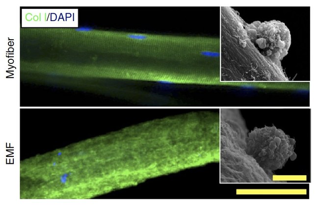 The artificial niche replicates the environment of muscle stem cells through enriched media and structural support via engineered muscle fibers (EMFs). This confocal microscopy image shows how EMFs replicate the shape and collagen content (green) of a muscle fiber (myofiber) to tether isolated muscle stem cells (blue). High resolution electron micrographs on right confirm muscle stem cell anchoring. (Source: Turn Biotechnologies)