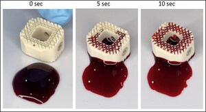 Zavation Medical Products, LLC,  Launches Zavation LABYRINTH™ Fully Porous PEEK Cage