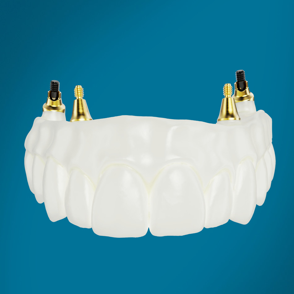 The new NobelProcera® Zirconia Implant Bridge simplifies the