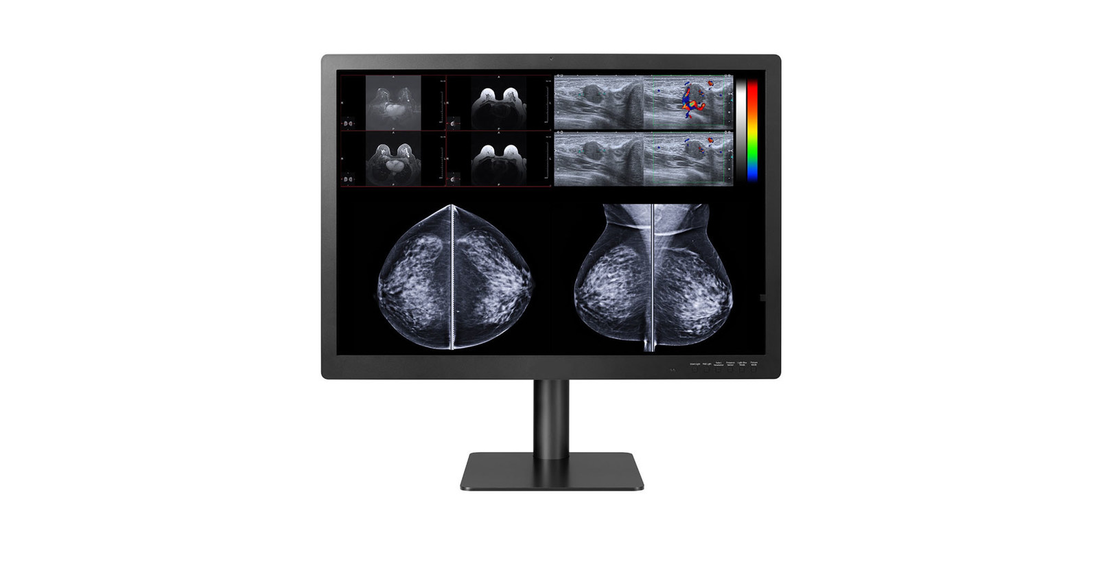 Double Black Imaging Expands PACS and Breast Imaging Display Solutions with 12MP Display Double Black Imaging Expands PACS and Breast Imaging Display Solutions with 12MP Display