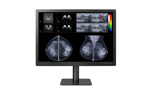 Gemini 12MP from Double Black Imaging Expands Breast Imaging and PACS Display Solutions