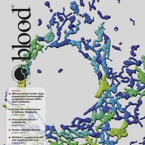 Research Study Shows 'Functional Fluidics' Biomarkers Can Help Predict Sickle Cell Disease Pain Crises and Monitor Drug Therapy Progress