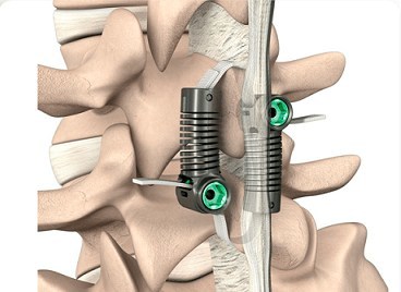 WEB限定】 Advances = 脊椎脊髄損傷アドバンス in Spi… and Spine 健康