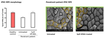 Figure 3. VP-001 treatment restores typical RPE morphology in penetrant patient iPSC-RPE Statistical significance calculated as one-way ANOVA *= p ≤ 0.05 in cells from a single patient across two technical replicates